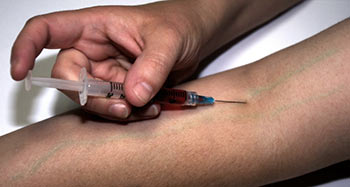 Terapia narkotykowa – 2 kroki do wyjścia z uzależnienia Terapia narkotykowa – 2 kroki do wyjścia z uzależnienia